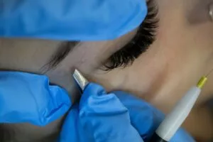 Épilation électrolyse des sourcils d'une femme réalisée par une esthéticienne Maelis centre laser