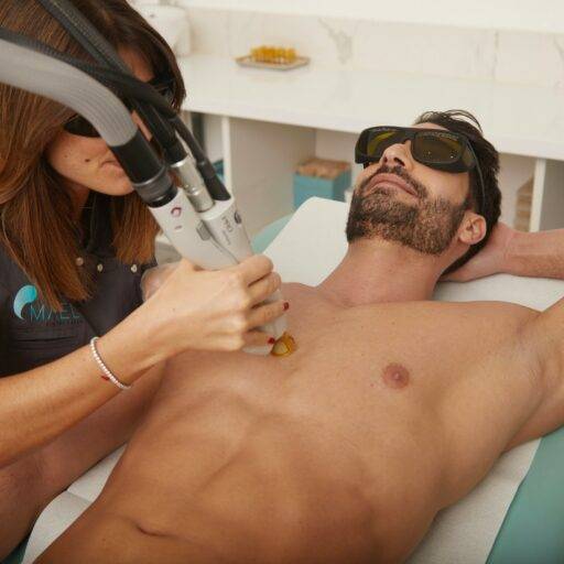 Homme recevant un traitement d'épilation laser au torse